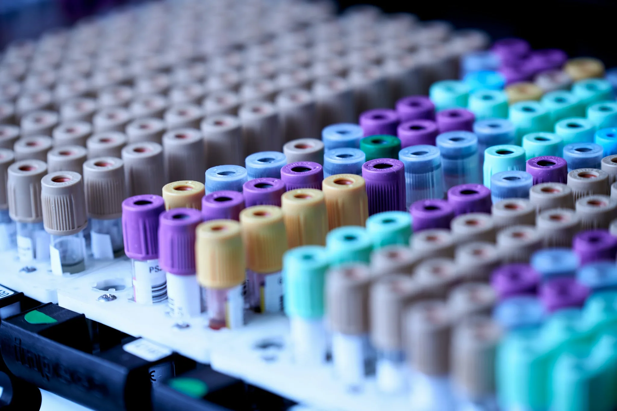 Blood collection tubes in a laboratory rack