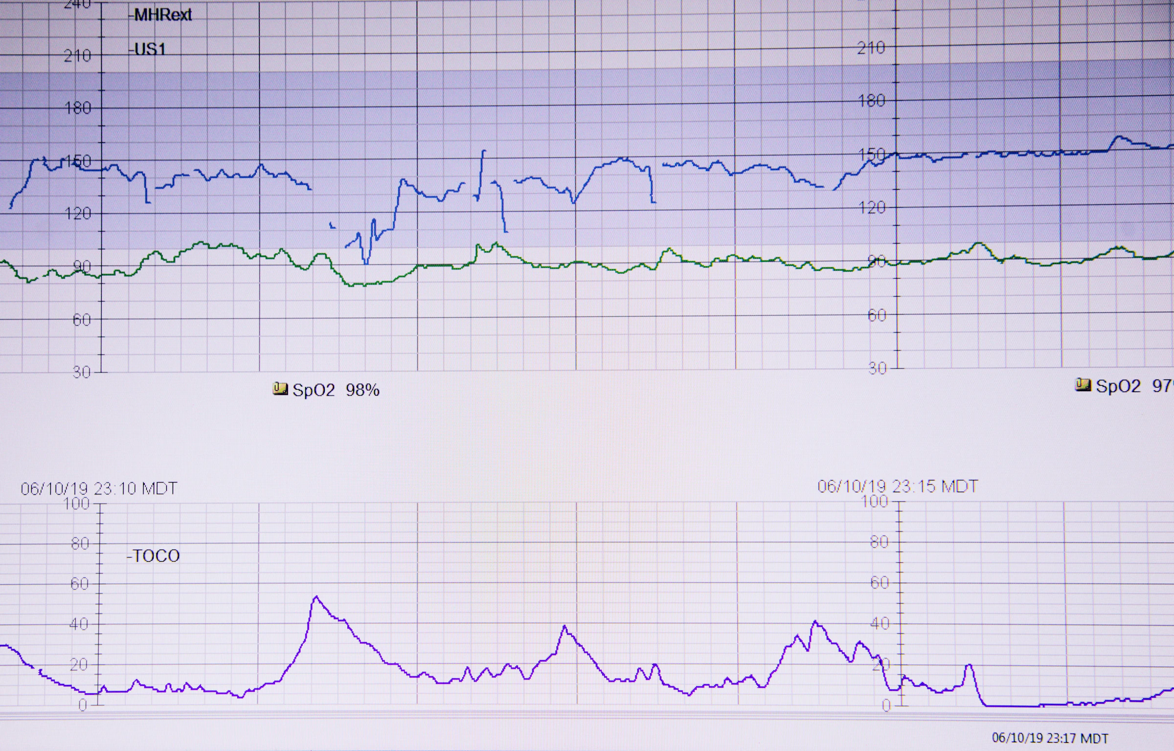 An ECG heartbeat trace on paper,